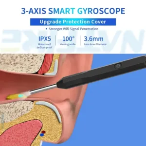 Ear Wax Removal - WiFi Otoscope