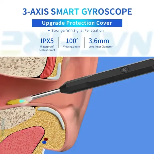 Ear Wax Removal - WiFi Otoscope