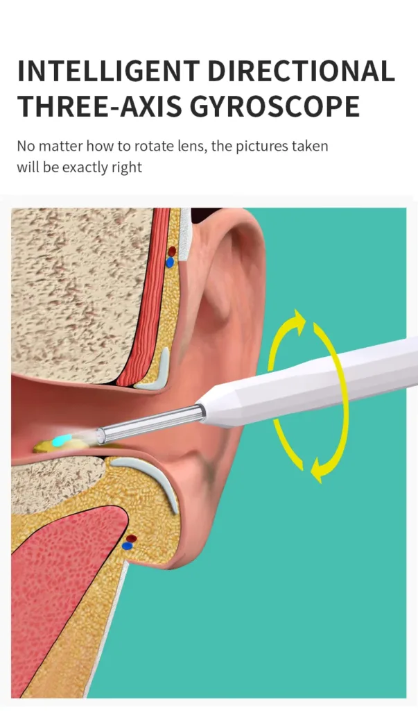 Ear Wax Removal - WiFi Otoscope